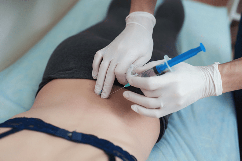 Blockade an der Lendeger Osteochondrose